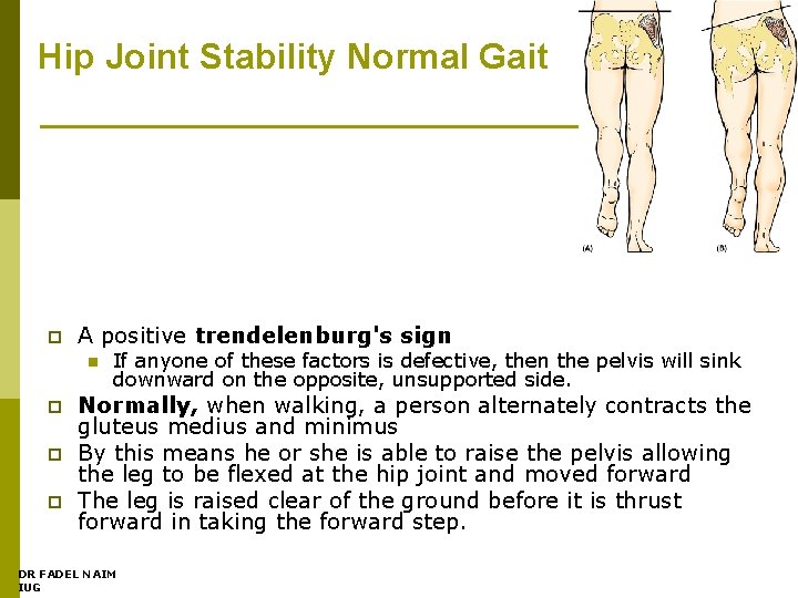 Hip Joint Stability Normal Gait p A positive trendelenburg's sign n p p p