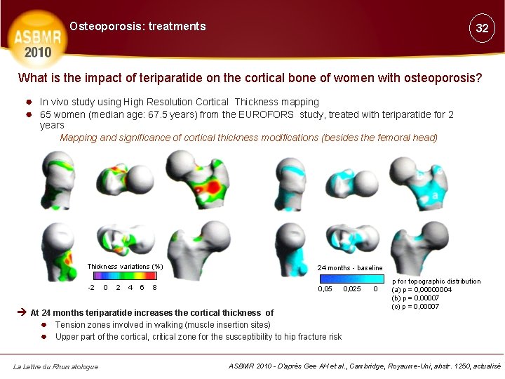 Osteoporosis: treatments 32 What is the impact of teriparatide on the cortical bone of