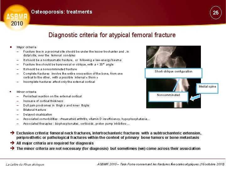 Osteoporosis: treatments 25 Diagnostic criteria for atypical femoral fracture ● Major criteria – Fracture