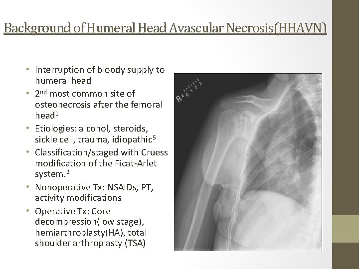 Background of Humeral Head Avascular Necrosis(HHAVN) • Interruption of bloody supply to humeral head