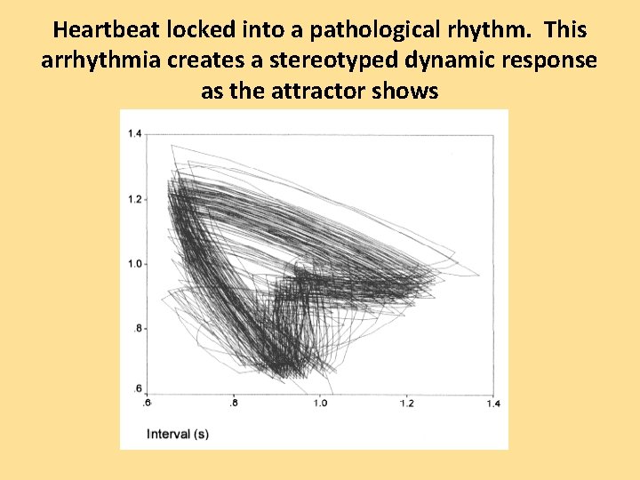 Heartbeat locked into a pathological rhythm. This arrhythmia creates a stereotyped dynamic response as