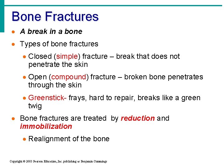Bone Fractures · A break in a bone · Types of bone fractures ·