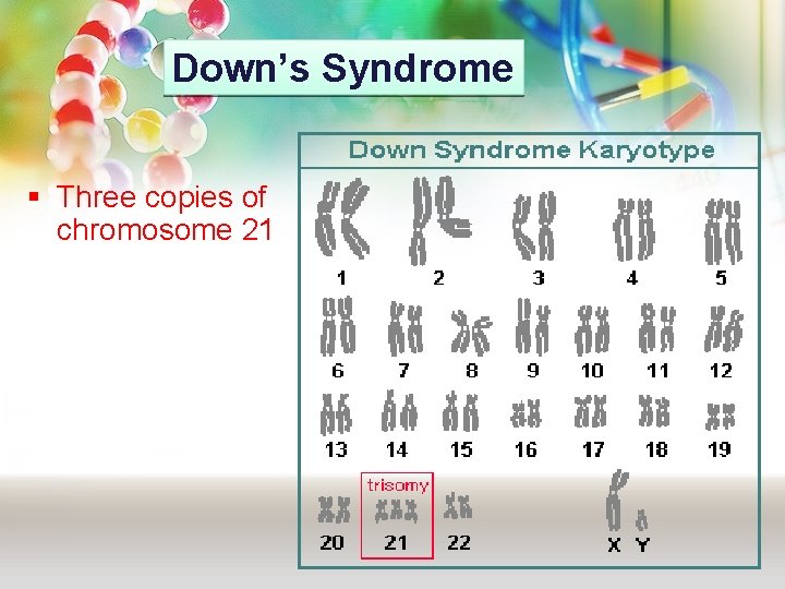Down’s Syndrome § Three copies of chromosome 21 