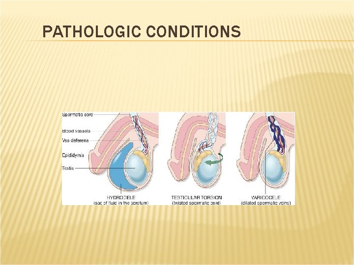PATHOLOGIC CONDITIONS PATHOLOGIC CONDITIONS