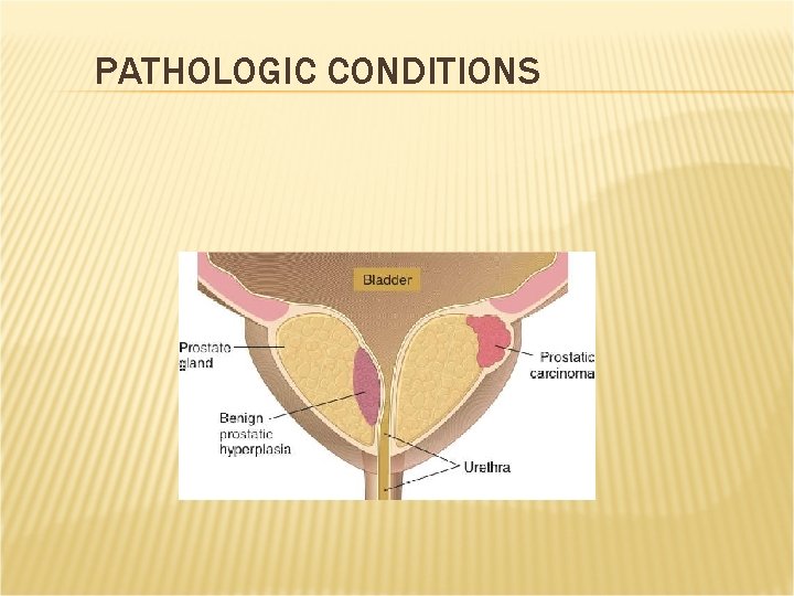 PATHOLOGIC CONDITIONS PATHOLOGIC CONDITIONS