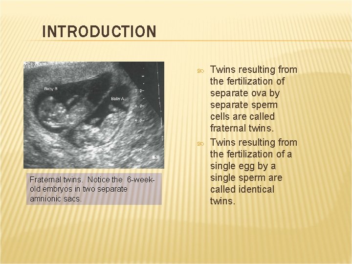 INTRODUCTION Fraternal twins. Notice the 6 -weekold embryos in two separate amnionic sacs. Twins INTRODUCTION Fraternal twins. Notice the 6 -weekold embryos in two separate amnionic sacs. Twins