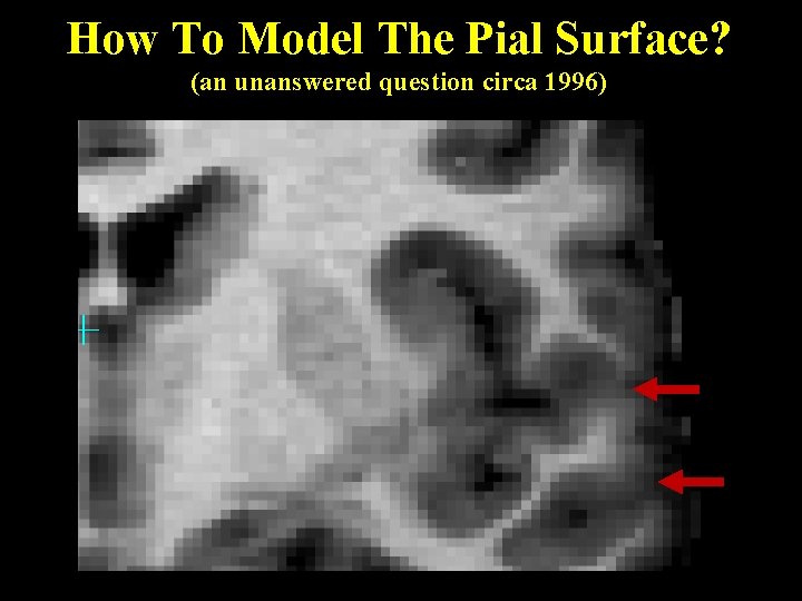 How To Model The Pial Surface? (an unanswered question circa 1996) 