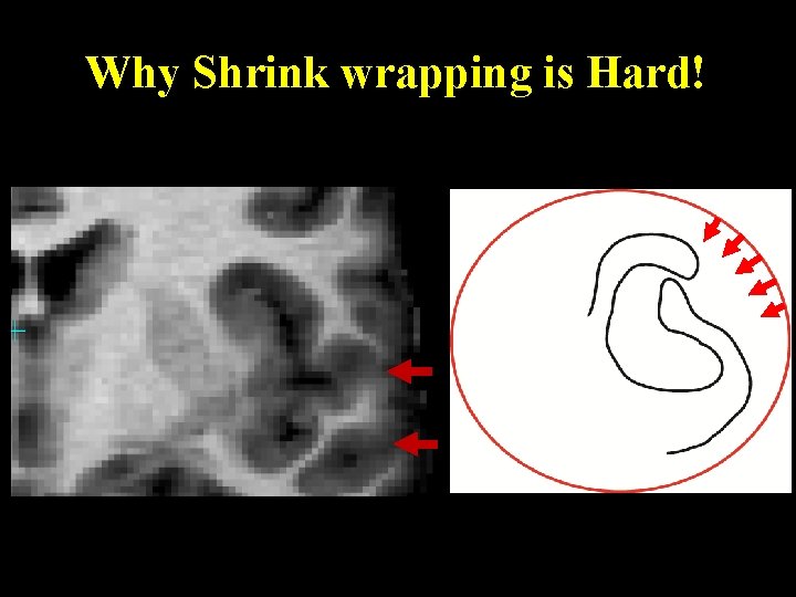 Why Shrink wrapping is Hard! 
