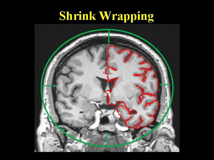 Shrink Wrapping 