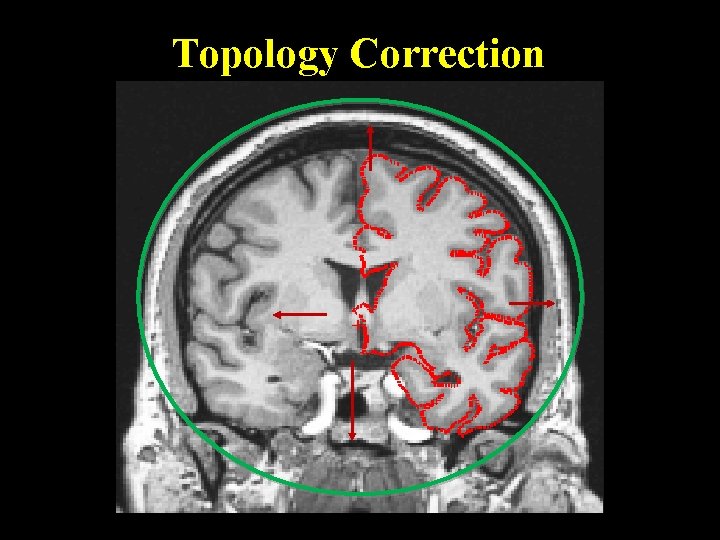 Topology Correction 