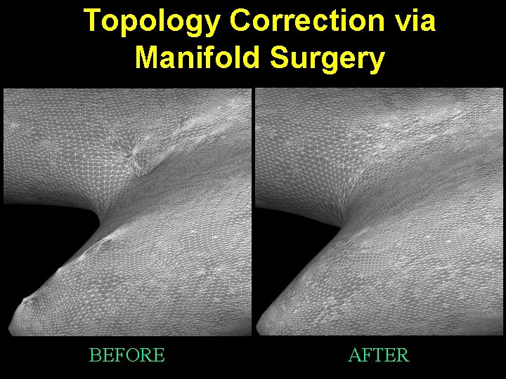 Topology Correction via Manifold Surgery BEFORE AFTER 