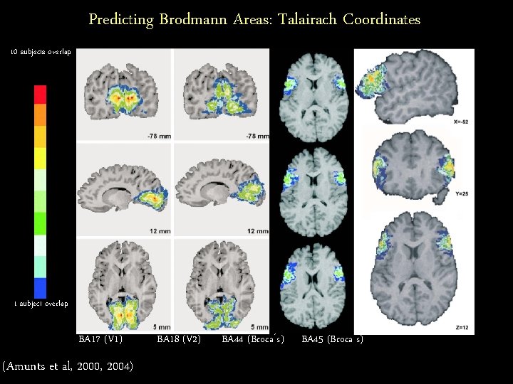 Predicting Brodmann Areas: Talairach Coordinates 10 subjects overlap 1 subject overlap BA 17 (V