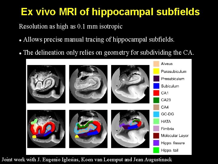 Ex vivo MRI of hippocampal subfields Resolution as high as 0. 1 mm isotropic