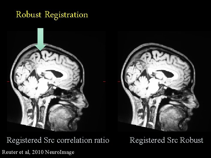 Robust Registration Registered Src correlation ratio Reuter et al, 2010 Neuro. Image Registered Src