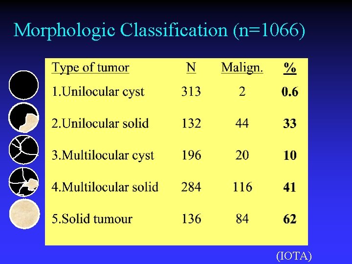 Ovarile Neoformatie Diagnose Dirk Timmerman Dienst Verloskunde Gynaecologie
