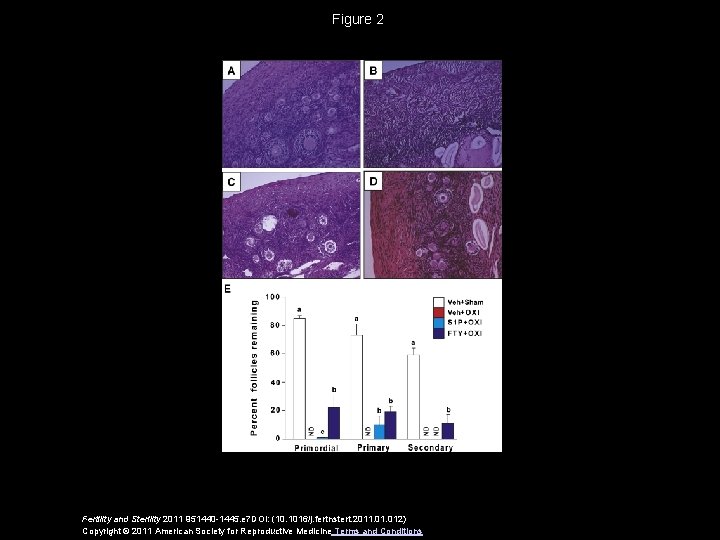 Figure 2 Fertility and Sterility 2011 951440 -1445. e 7 DOI: (10. 1016/j. fertnstert.