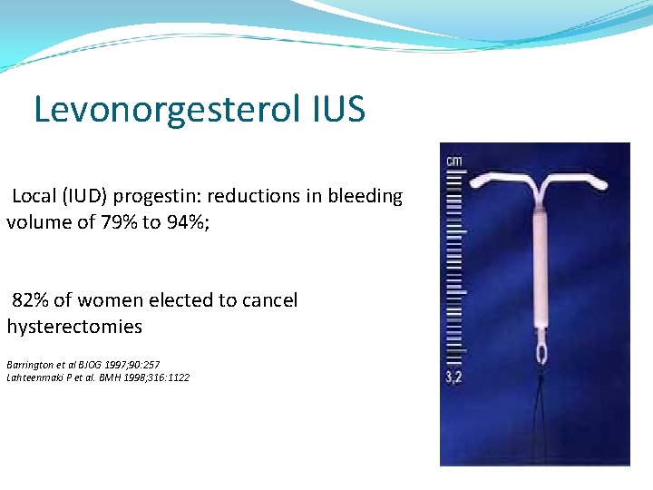 Levonorgesterol IUS Local (IUD) progestin: reductions in bleeding volume of 79% to 94%; 82%