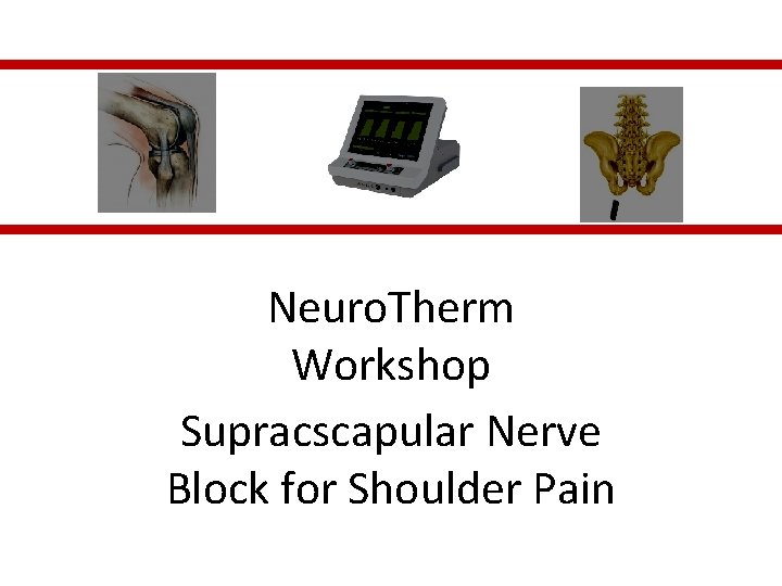 Neuro. Therm Workshop Supracscapular Nerve Block for Shoulder Pain 