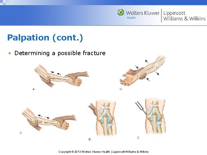 Palpation (cont. ) • Determining a possible fracture Copyright © 2013 Wolters Kluwer Health