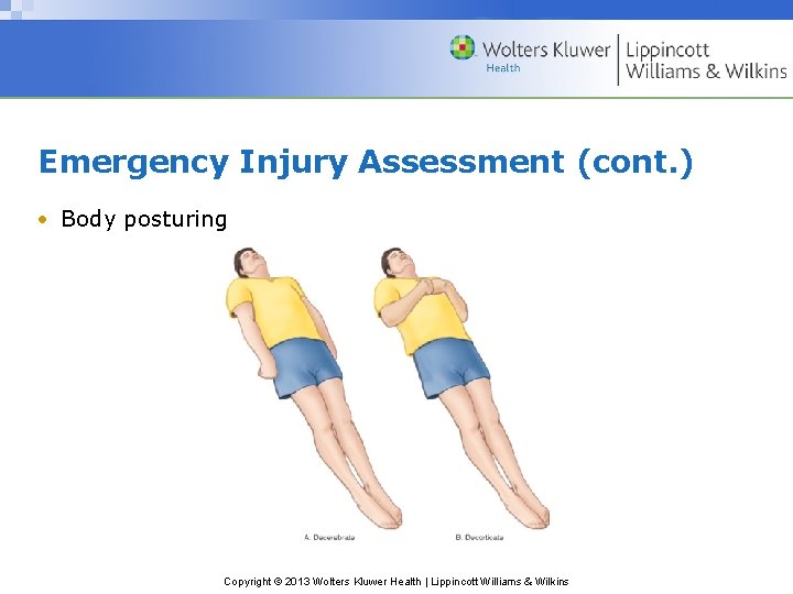 Emergency Injury Assessment (cont. ) • Body posturing Copyright © 2013 Wolters Kluwer Health