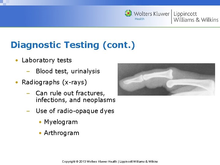 Diagnostic Testing (cont. ) • Laboratory tests – Blood test, urinalysis • Radiographs (x-rays)