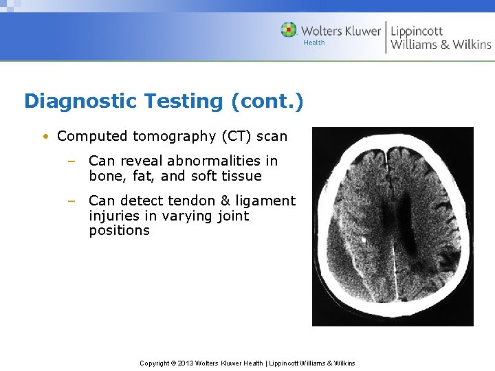 Diagnostic Testing (cont. ) • Computed tomography (CT) scan – Can reveal abnormalities in