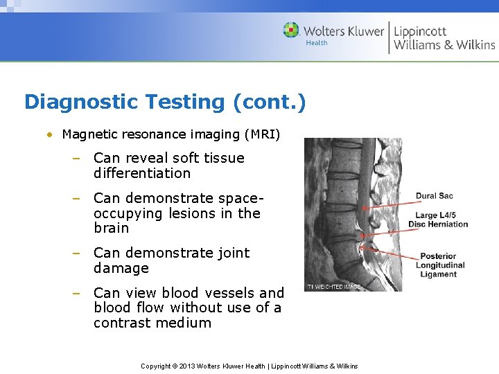 Diagnostic Testing (cont. ) • Magnetic resonance imaging (MRI) – Can reveal soft tissue