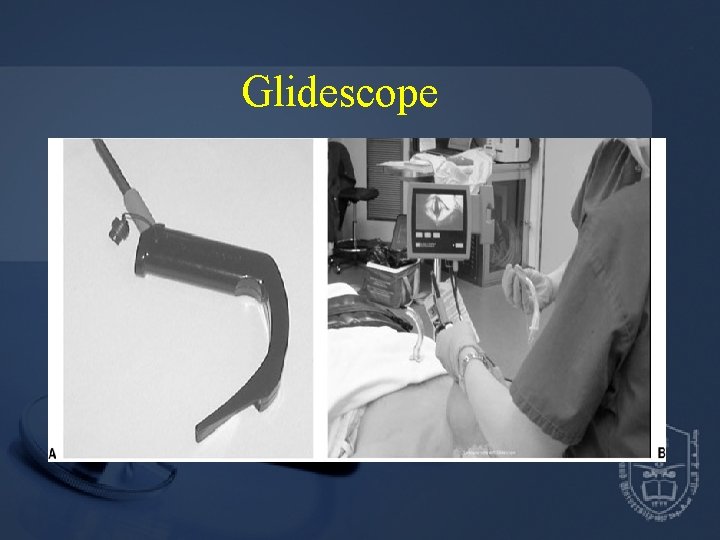 Glidescope 