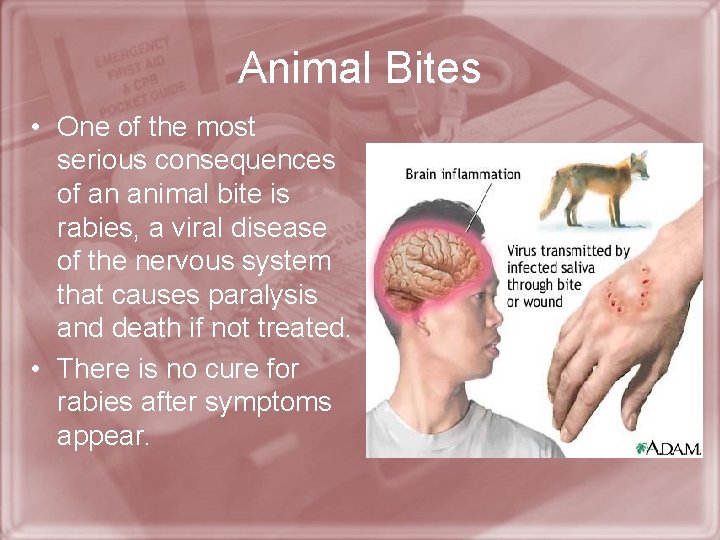 Animal Bites • One of the most serious consequences of an animal bite is