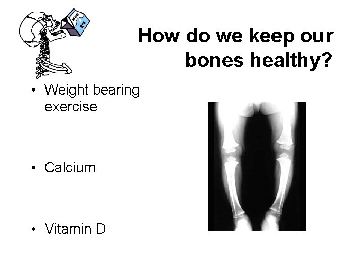 How do we keep our bones healthy? • Weight bearing exercise • Calcium •
