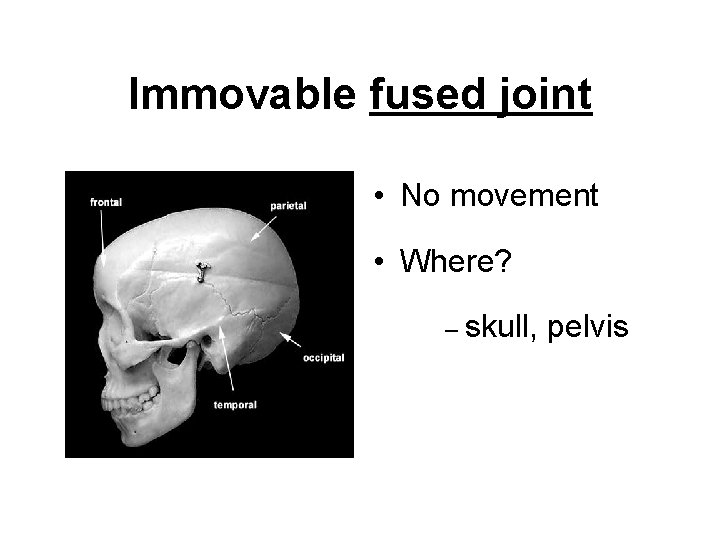 Immovable fused joint • No movement • Where? – skull, pelvis 