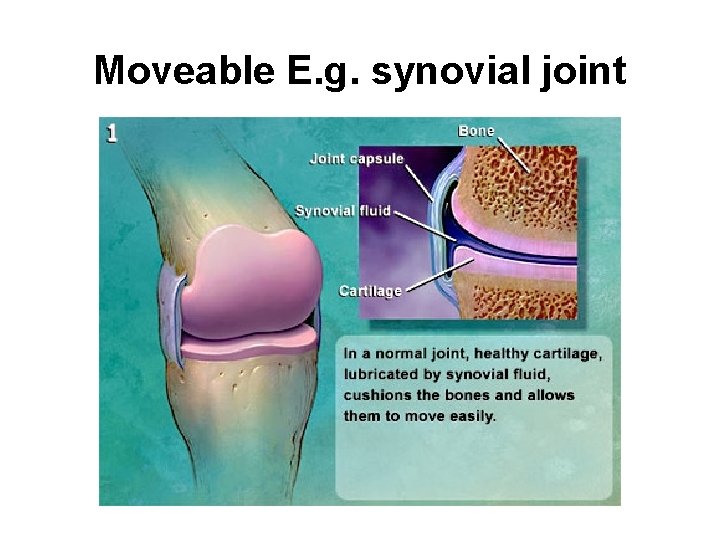 Moveable E. g. synovial joint 