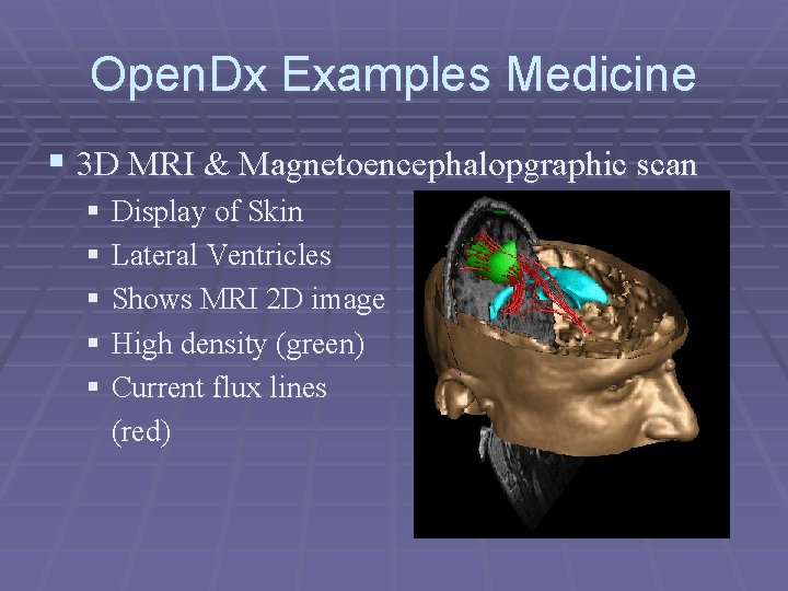 Open. Dx Examples Medicine § 3 D MRI & Magnetoencephalopgraphic scan § Display of