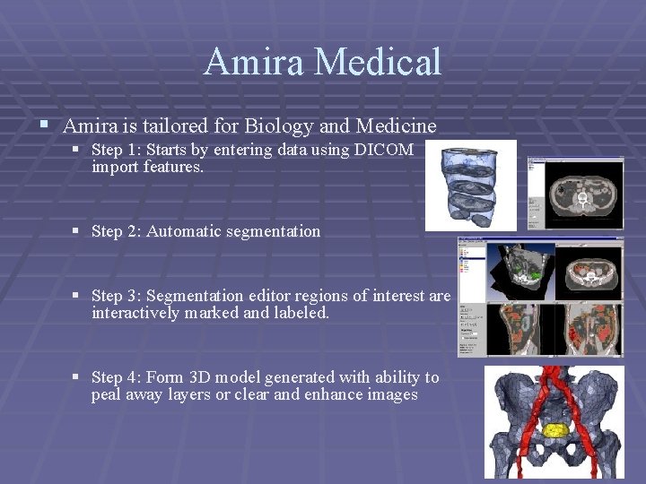 Amira Medical § Amira is tailored for Biology and Medicine § Step 1: Starts