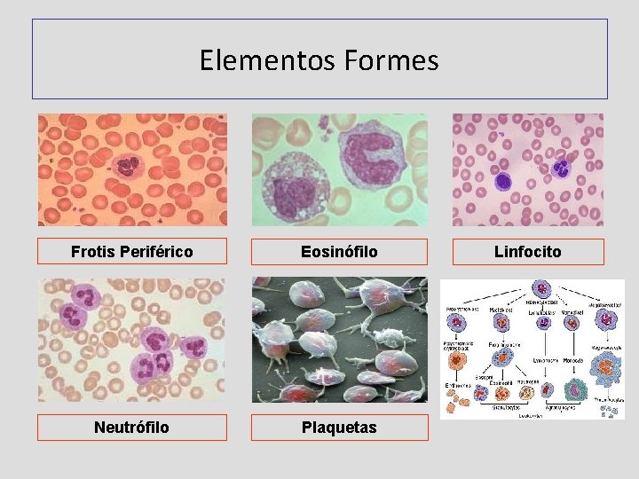 Elementos Formes Frotis Periférico Eosinófilo Neutrófilo Plaquetas Linfocito 
