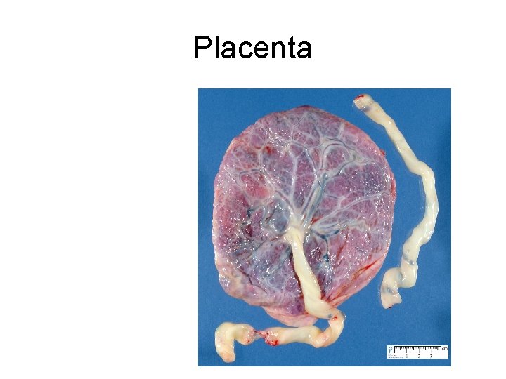 Placenta 