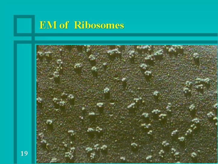 EM of Ribosomes 19 EM of Ribosomes 19