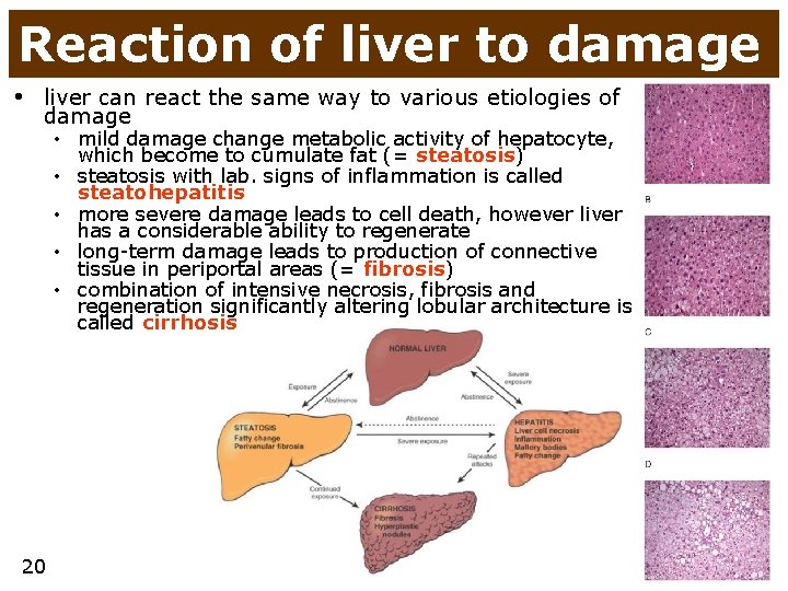 Reaction of liver to damage • liver can react the same way to various
