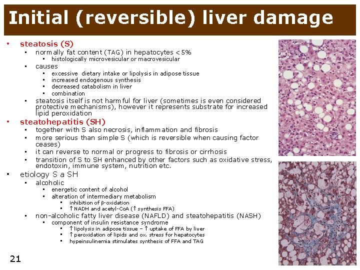 Initial (reversible) liver damage • • steatosis (S) • normally fat content (TAG) in