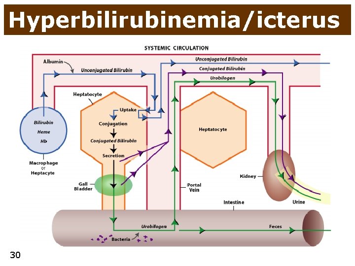 Hyperbilirubinemia/icterus 30 