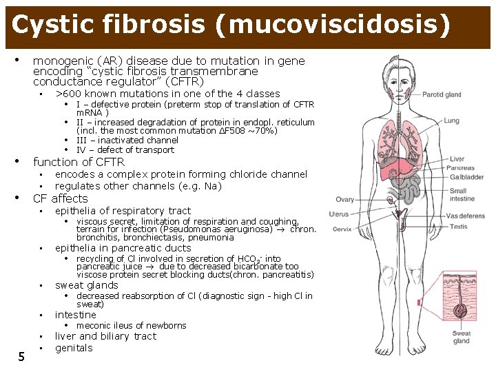 Cystic fibrosis (mucoviscidosis) • monogenic (AR) disease due to mutation in gene encoding “cystic