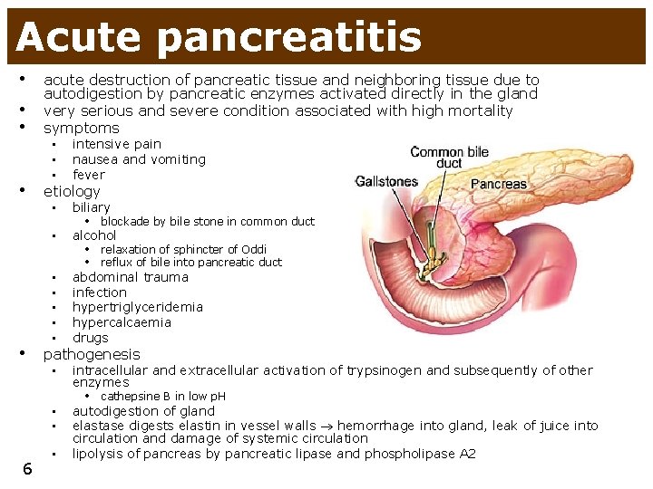 Acute pancreatitis • • • acute destruction of pancreatic tissue and neighboring tissue due