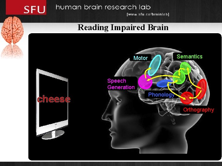 Reading Impaired Brain Semantics Motor Speech Generation cheese Phonology Orthography 