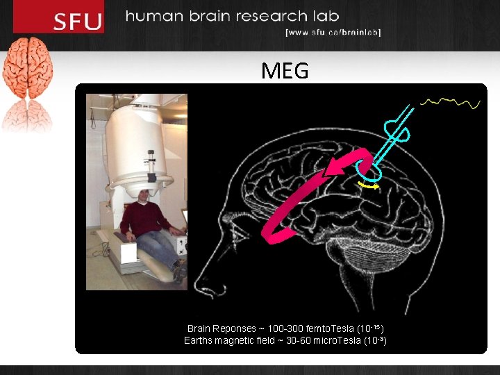 MEG Brain Reponses ~ 100 -300 femto. Tesla (10 -15) Earths magnetic field ~