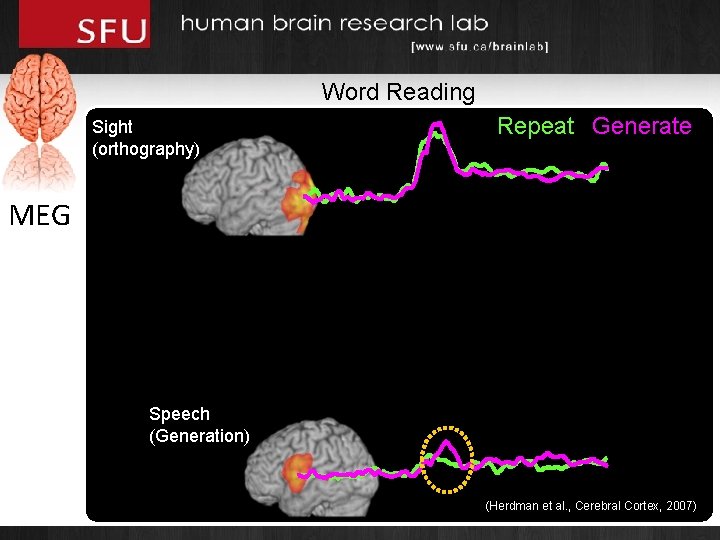 Word Reading Sight (orthography) Repeat Generate MEG Speech (Generation) (Herdman et al. , Cerebral