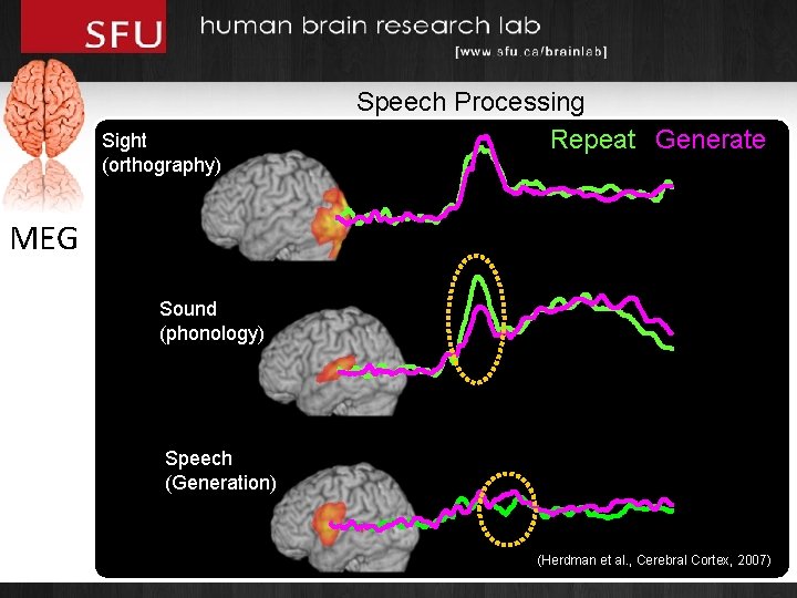 Sight (orthography) Speech Processing Repeat Generate MEG Sound (phonology) Speech (Generation) (Herdman et al.