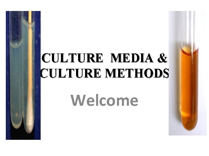 CULTURE MEDIA & CULTURE METHODS Welcome 