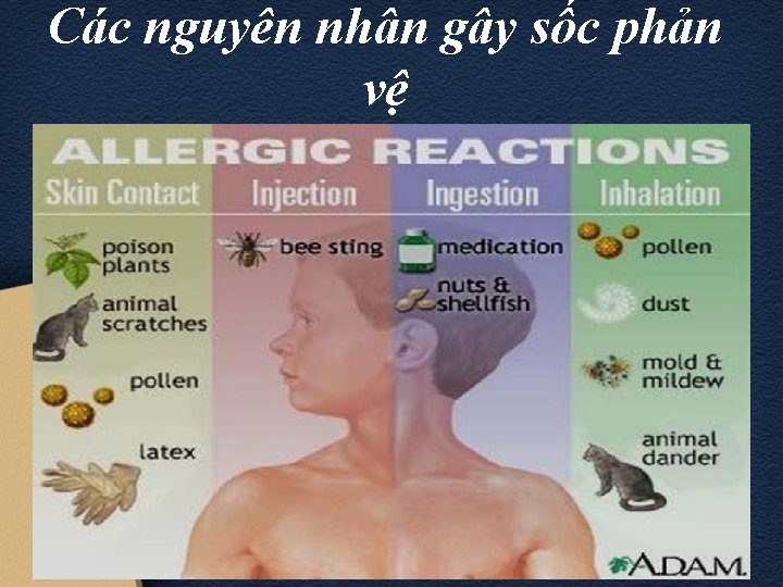 Các nguyên nhân gây sốc phản vệ 