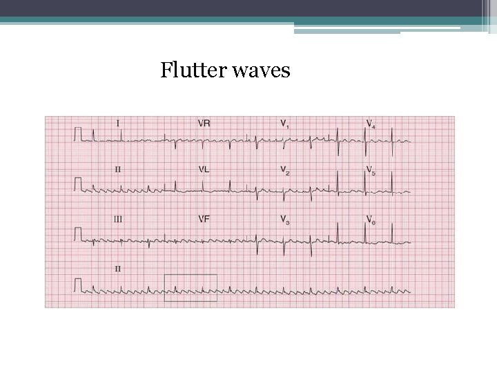 Flutter waves 