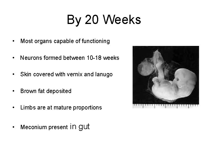 By 20 Weeks • Most organs capable of functioning • Neurons formed between 10